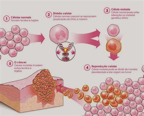 Blog Da Florência CÂncer Fatores De Risco E Tratamento