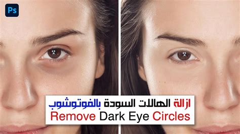 ازالة الهالات السوداء بالفوتوشوب Remove Dark Eye Circles Youtube