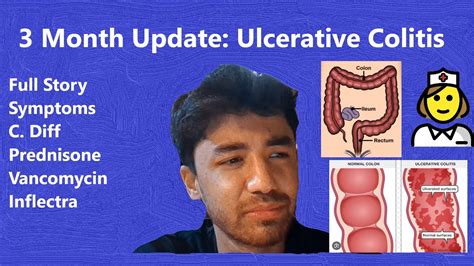 Opening Up About My Ulcerative Colitis 3 Month Update C Diff Prednisone And Inflectra Youtube