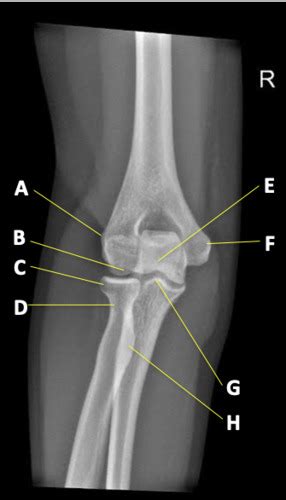 Chapter 4 2 Forearm And Elbow Flashcards Quizlet