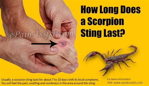 How Long Does A Scorpion Sting Last And What To Do If You Get Stung By A Scorpion