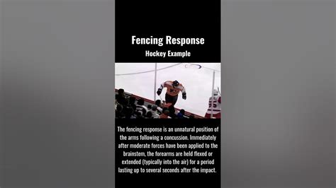 Fencing Response Example Courtesy Of Hockey Youtube