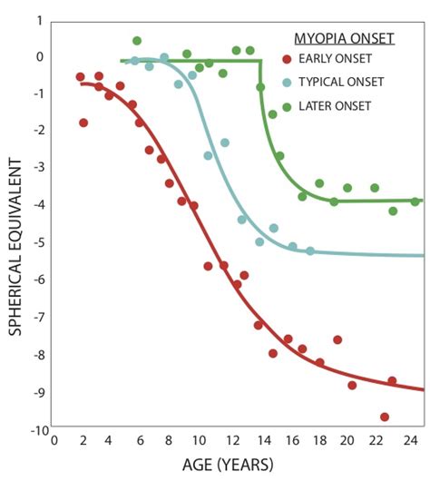 Myopia Onset Review Of Myopia Management