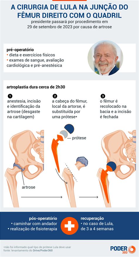 Entenda Como Ser A Opera O De Lula Para Colocar Pr Tese No F Mur