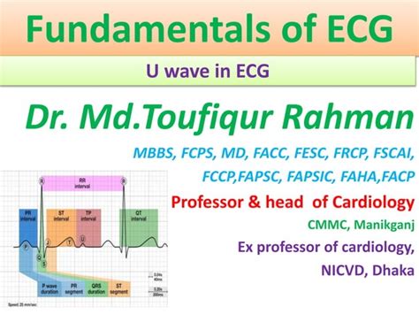 Approach to a patient with U wave in ECG | PPT