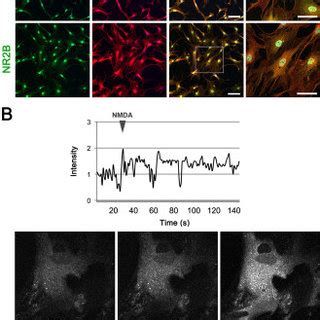 Upregulation Of Drp And Pdrp Protein Expression In Glaucomatous Human