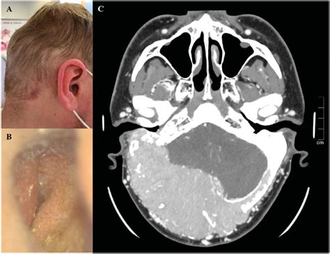 The Clinical And Radiological Findings Of The Patient The Patient Had