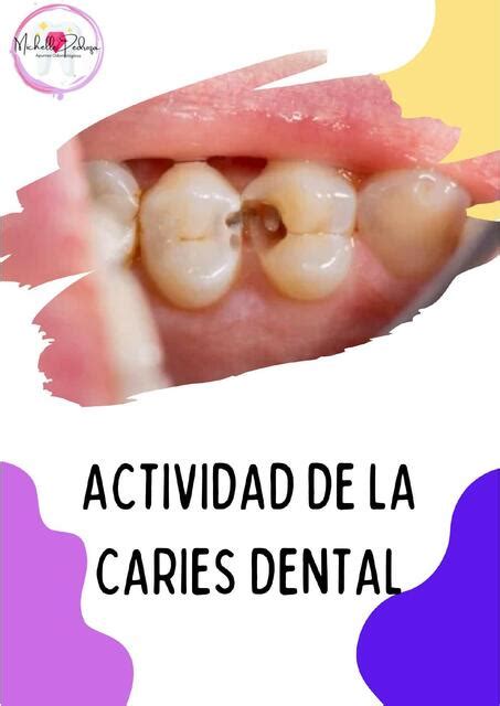 Actividad De La Caries Dental Michelle Pedroza UDocz