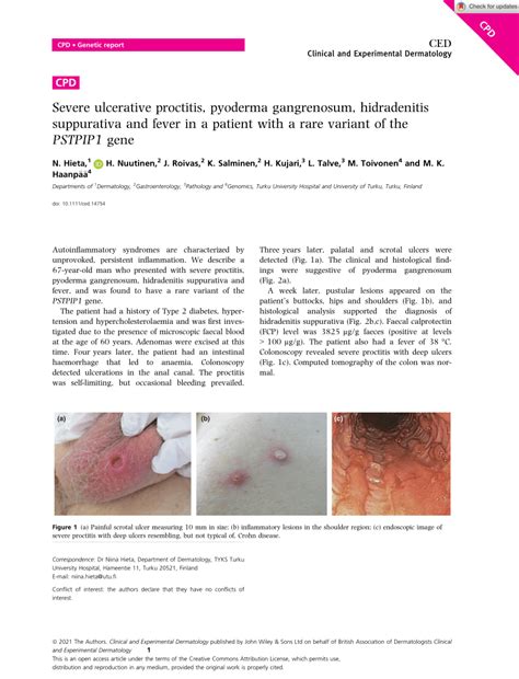 Pdf Severe Ulcerative Proctitis Pyoderma Gangrenosum Hidradenitis Suppurativa And Fever In A