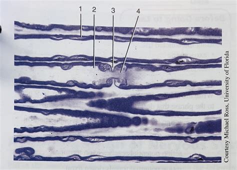 teased myelinated axon Diagram | Quizlet