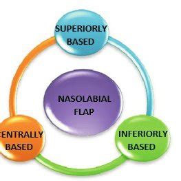 Types of nasolabial flap The flap can be used unilaterally or ...