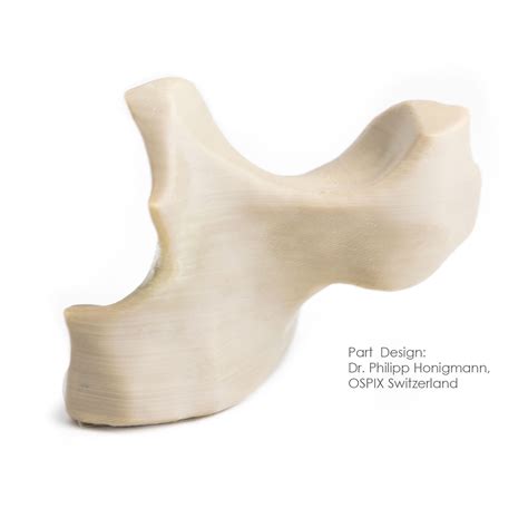 Process Workflow for 3D Printed Patient-Specific Medical Devices