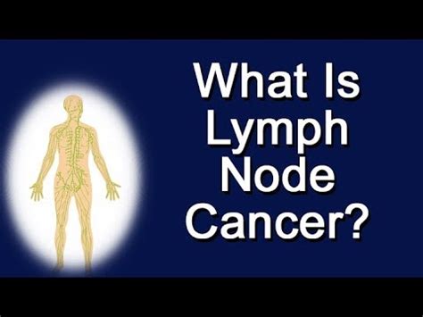 Stage 2 Cancer Lymph Nodes