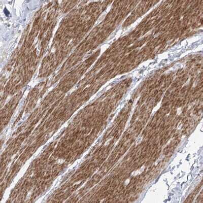 Zinc finger protein 180 Antibody (NBP1-92613): Novus Biologicals