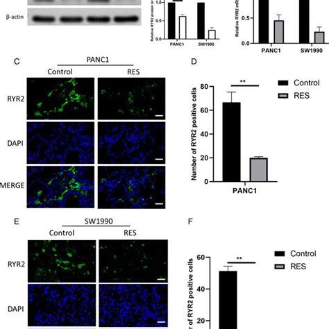 Ryr Knockdown Inhibits Proliferation Migration And Invasiveness Of