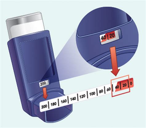 LUPIN | Albuterol Inhaler Help and Support