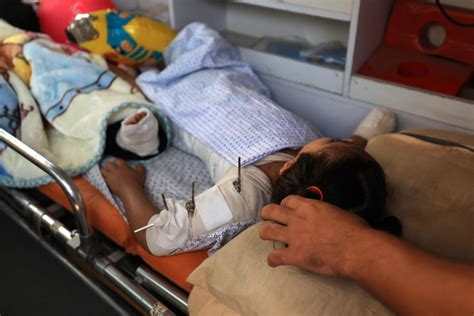 First group of wounded Palestinian children from Israel-Gaza war ...