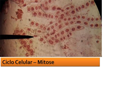 SOLUTION 5 Ciclo Celular Mitose Diferencia O Studypool