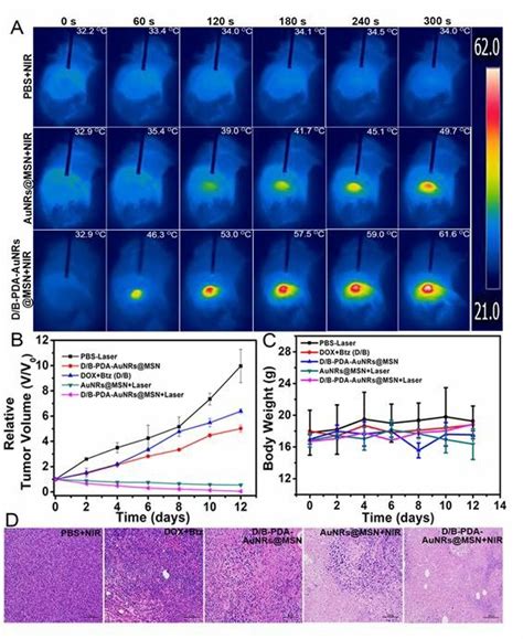 The Infrared Thermal Images Of 4T1 Tumor Bearing Mice With Intravenous