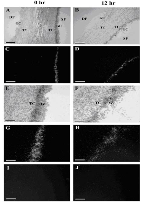 In Situ Localization Of Cart Mrna Within Granulosa Cells Of Dominant