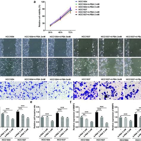 Inhibition Of ER Stress Inhibits Cell Viability Migration And Invasion