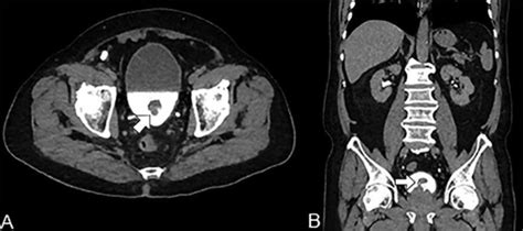 Ct Scan Of The Abdomen And Pelvis With Elimination Phase In Axial Download Scientific Diagram