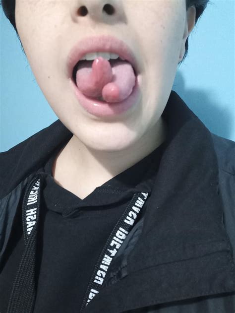 Tongue Split Update 10 Days Info In Comments R Bodymods