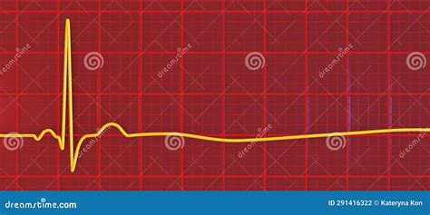 ECG In Asystole, 3D Illustration Royalty-Free Cartoon | CartoonDealer ...