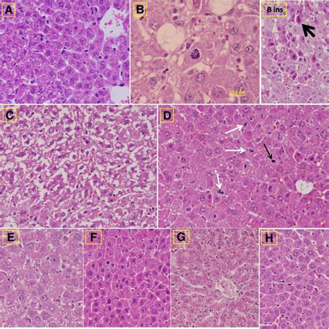 Photomicrographs For Liver Sections Of The Different Groups A Download Scientific Diagram