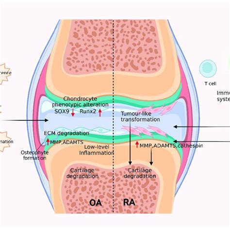 Mechanisms Of Cartilage Damage In Oa And Ra Left In Oa Different