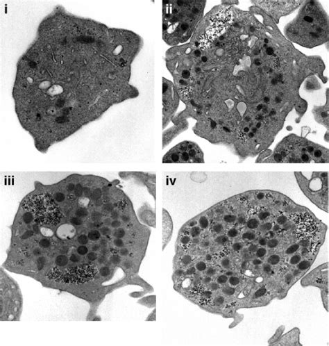 Defective Platelet Responsiveness To Thrombin And Protease‐activated