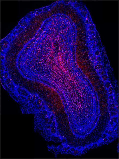 Scientists search for new methods to cure neurodegenerative diseases