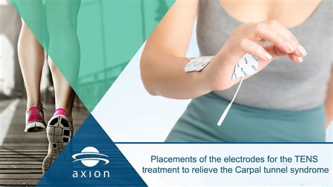 Carpal Tunnel Syndrome Correct Electrodes Placement For A Pain Relief