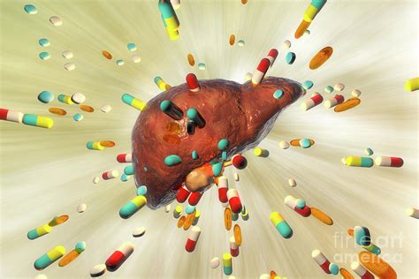 Drug Induced Hepatotoxicity Photograph By Kateryna Kon Science Photo