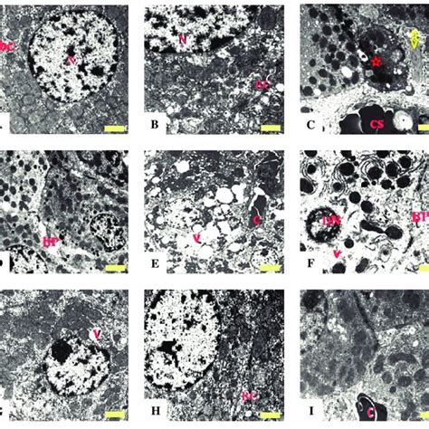 Electron Micrograph Picture Of Rat Liver Sections In Treatment Groups Download Scientific