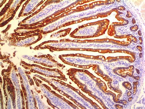 Villin Antibody CWWB1 Bio SB