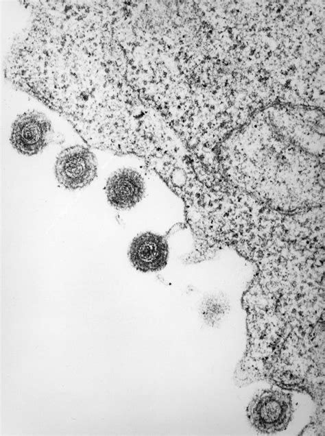electron micrograph  human herpes virus type  biology  human
