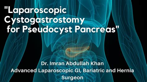 Laparoscopic Cystogastrostomy For Pseudocyst Pancreas Totally Sutured Dr Imran Abdullah