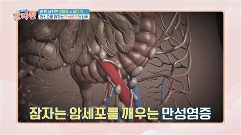 한번 생기면 걷잡을 수 암 기폭제 역할을 하는 만성염증 Jtbc 230713 방송 Zum Tv