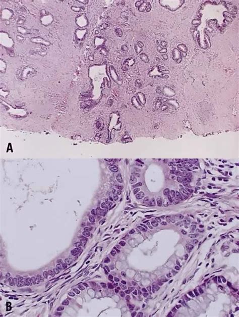 Pathology Atlas Cervix Glowm