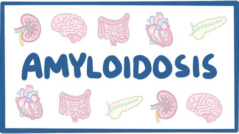 Amyloidosis - Causes, Symptoms, Diagnosis, Treatment, Pathology - 2024