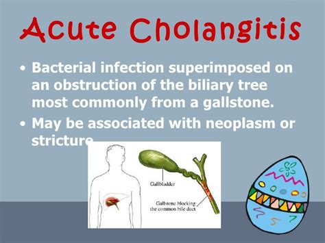 Acute Cholangitis