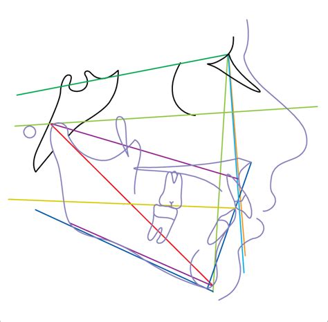 Skeletal Cephalometric Variables According To Dows Riedel Steiner Download Scientific