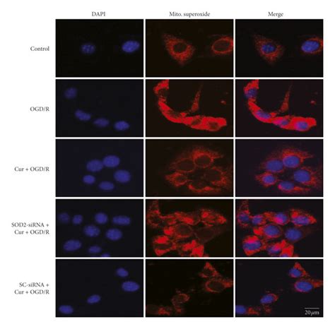 Sod Sirna Reversed Curcumin Induced Reduction Of Intracellular Ros And