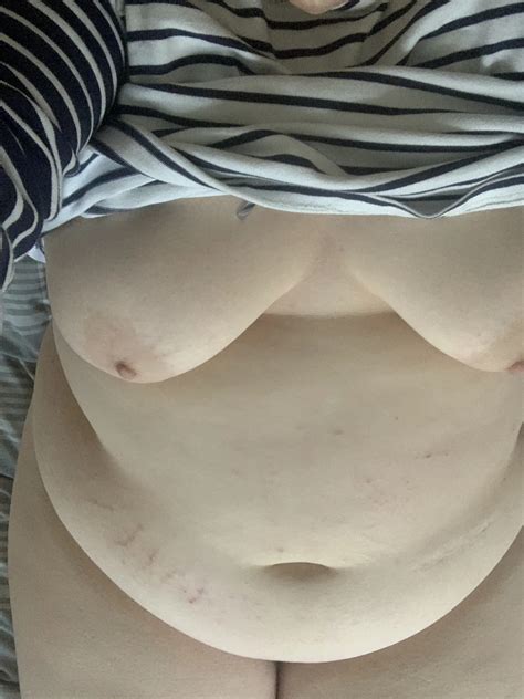 Any Takers 35 Nude Pics XHamster