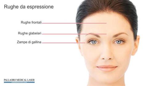 Botulino Tossina Botulinica In Medicina Estetica Pallaoro Medical Laser