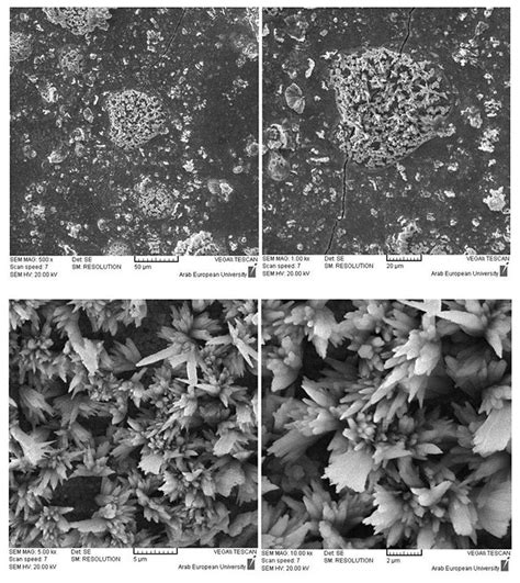 Biodentine Surface After 7 Days Of Immersion In Phosphate Solution And Download Scientific