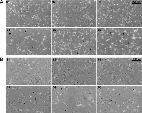 Morphologic Analysis Of U87 And U251 Transfected Cells A