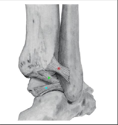 Figure 1 From Cadaveric Analysis Of The Distal Tibiofibular Syndesmosis