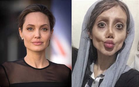 Esta iraniana fez 50 plásticas para ficar parecida Angelina Jolie